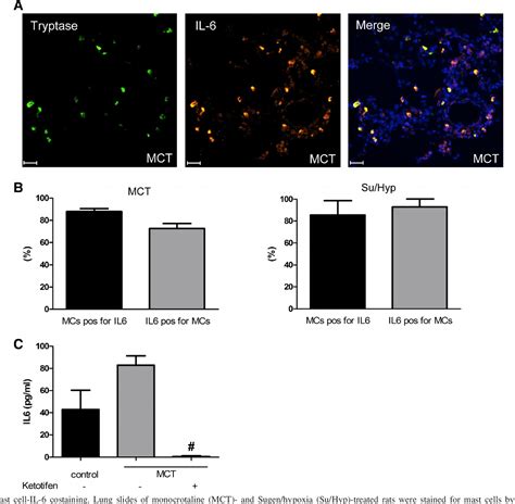 The mast cell–B cell axis in lung vascular remodeling and 